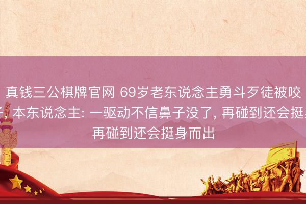 真钱三公棋牌官网 69岁老东说念主勇斗歹徒被咬掉鼻子, 本东说念主: 一驱动不信鼻子没了, 再碰到还会挺身而出